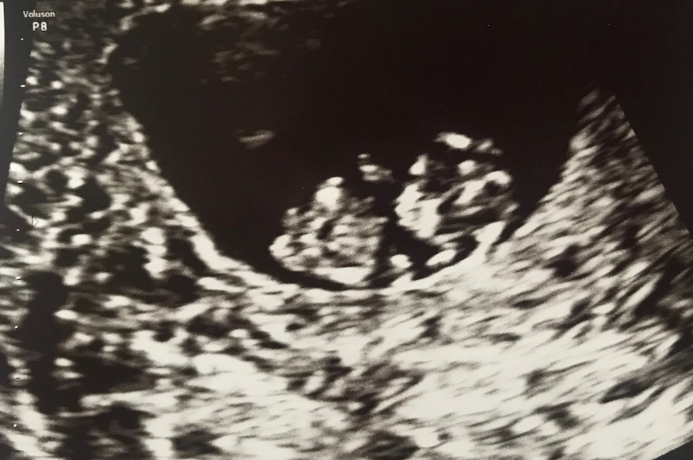 Tiny-Footprints-Blog-Pregnancy